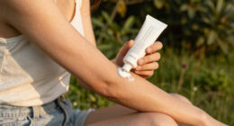 12 Best Sunburn Relief Lotions in 2026