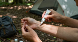 6 Best Spider Bite Treatments in 2026